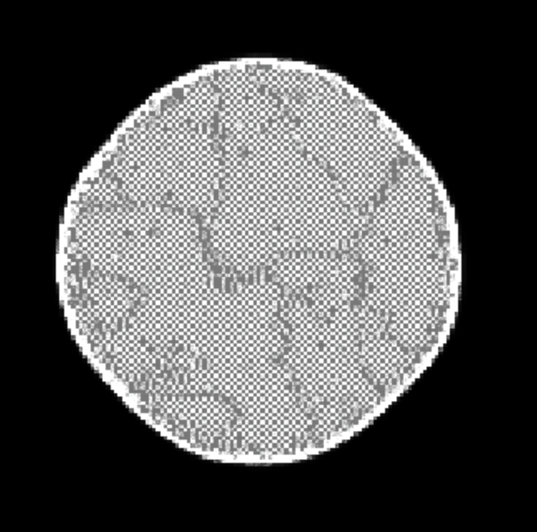 Ω-field simulator — Q35 topological selection, avascular tumor morphology